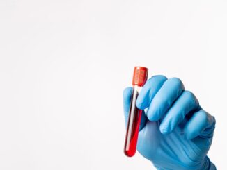 Krevní plazma ve vakuové zkumavce